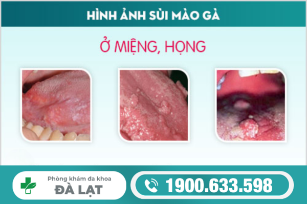 Hình ảnh minh họa